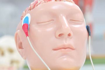 electromiografia comparticipada sns