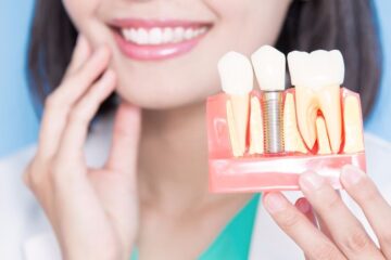 Implante Dentário em Portugal: Custos e O que Influencia Preços