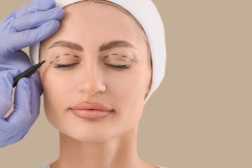 Preço da Blefaroplastia em Portugal: Valores e Fatores