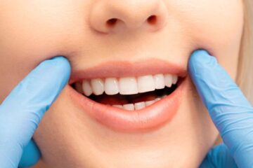 Preço de Branqueamento Dentário em Portugal: Guia Completo